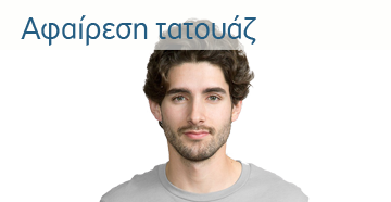 Αφαίρεση τατουάζ